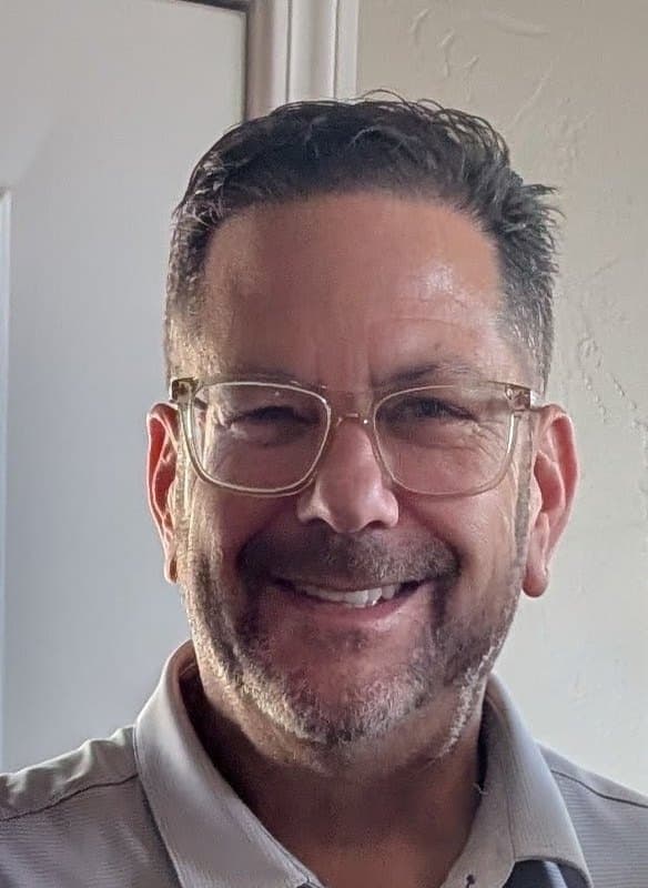 Tom Eggers after his transplant, hairline rebuilt