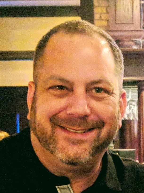 Tom Eggers before his transplant, hairline receded through the front